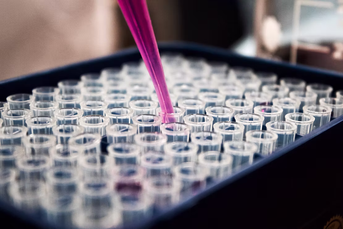 Detection of Milk Adulteration with water or any other substance using automated milk analyzers.
